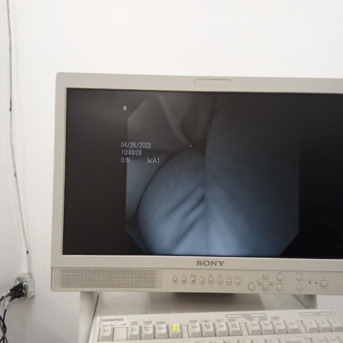 Olympus GIF-XTQ160 Gastroscope 