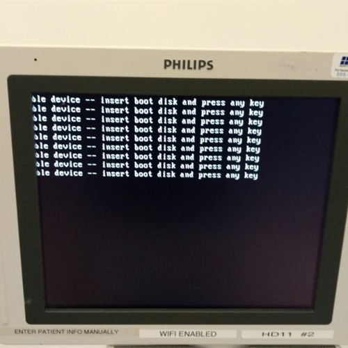 Philips HD11 XE Ultrasound
