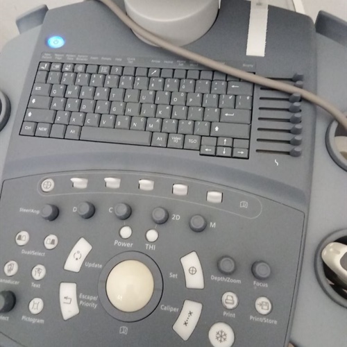 Siemens Acuson X150 Ultrasound Machine