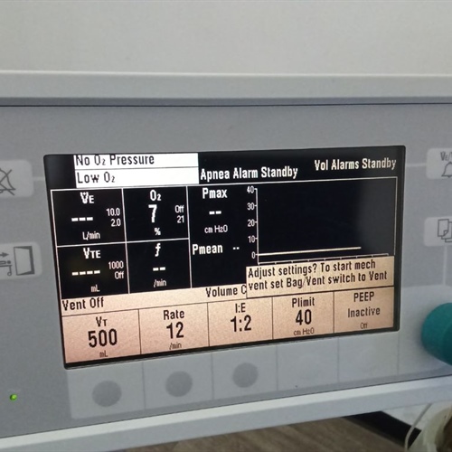Datex-Ohmeda S/5 Aespire Anesthesia Machine 