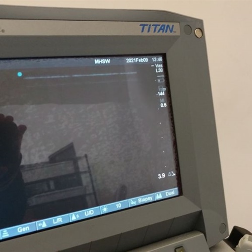 SonoSite Titan Ultrasound System w/ Probe